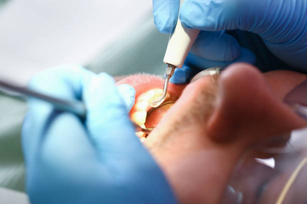Best Urgent Care for Lost Fillings or Crowns in Clive, IA